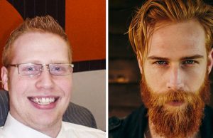 This man is growing a beard to keep the girls away.